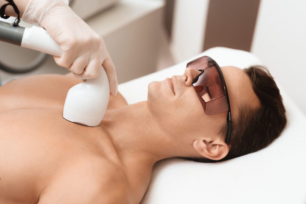 Body Laser Treatment