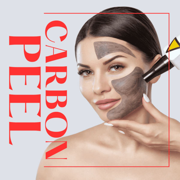 carbon peel shocasing female model showcasing main process of the treatment