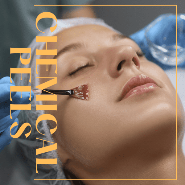 chemical peels showcasing a female model going through procedure