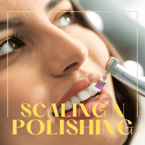 scaling and polishing procedure conducted on female patient along with text in design mentioning scaling and polishing