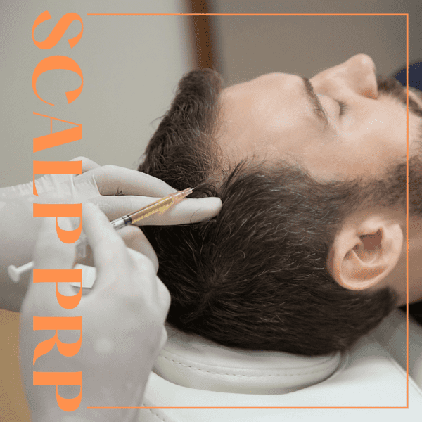 Scalp prp procedure being conducted on male patient