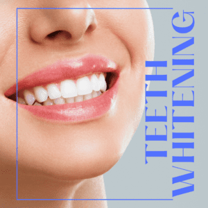 Teeth whitening where a female model showcases her teeth through her smile along with text in the design mentioning teeth whitening