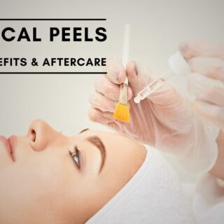 Chemical Peels Types, Benefits & Aftercare
