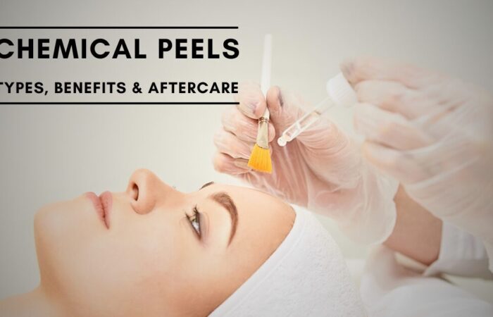 Chemical Peels page showcasing text and female model going through chemical peels procedure