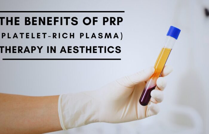 The Benefits of PRP by london aesthetics