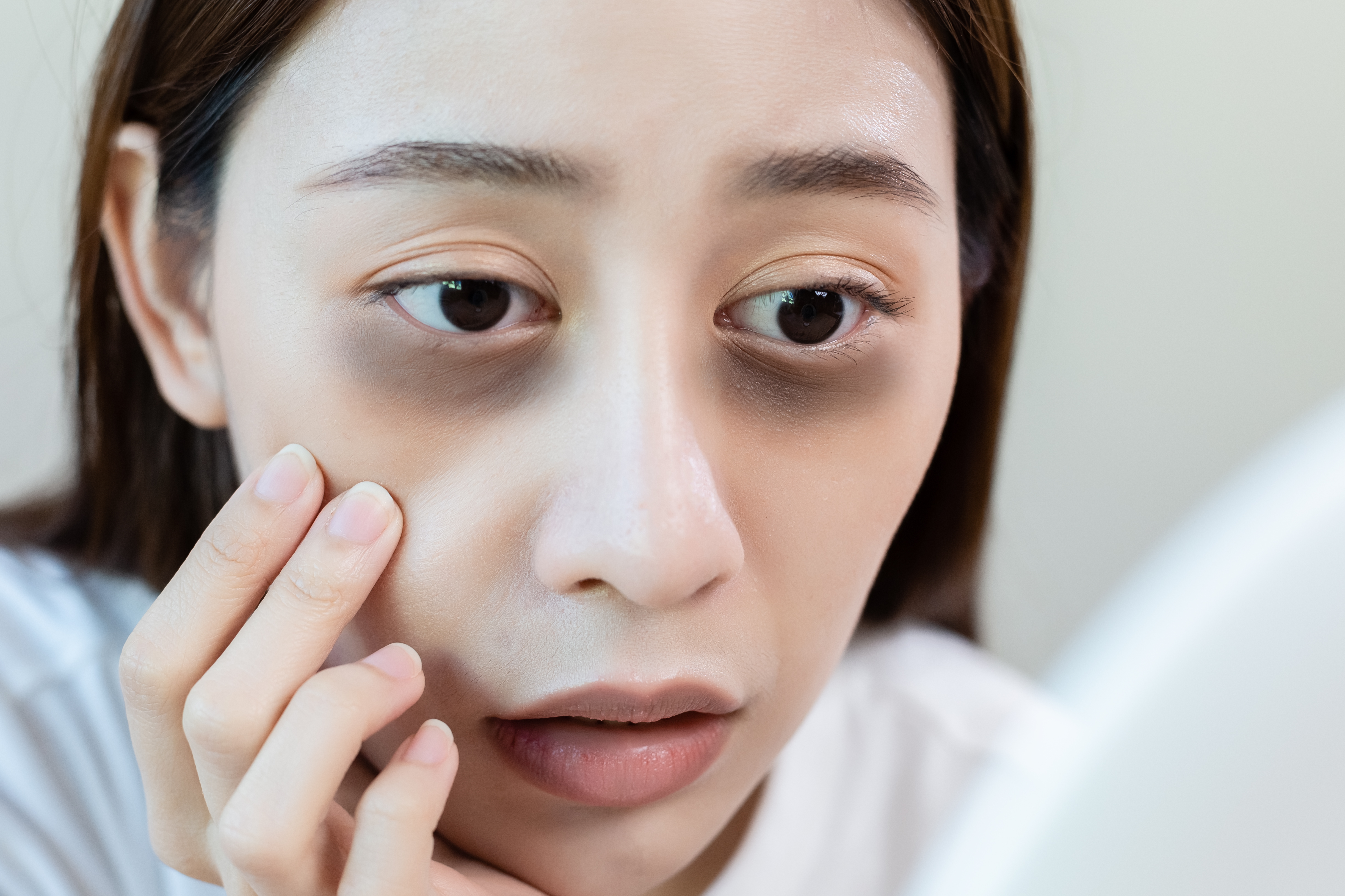 Dark Circles