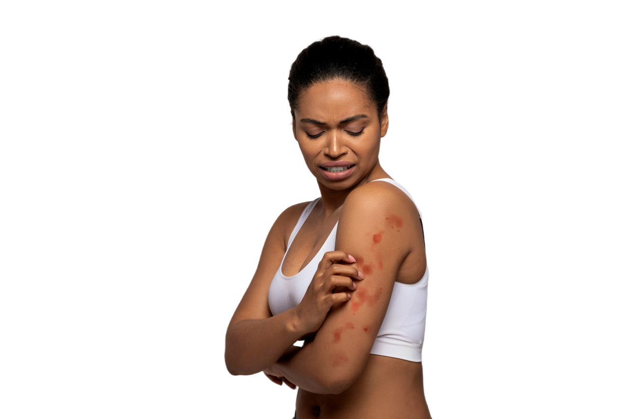 Skin Conditions
