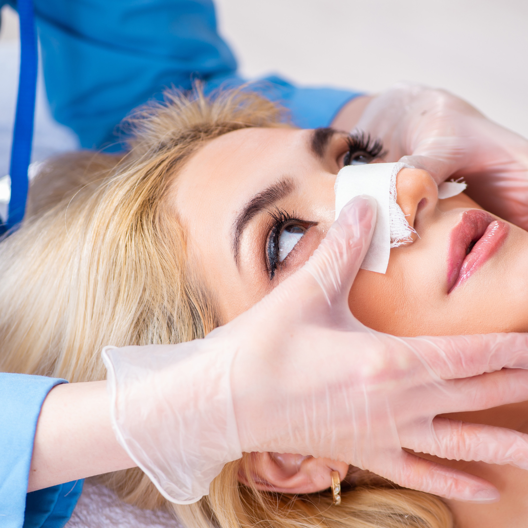 Rahinoplasty