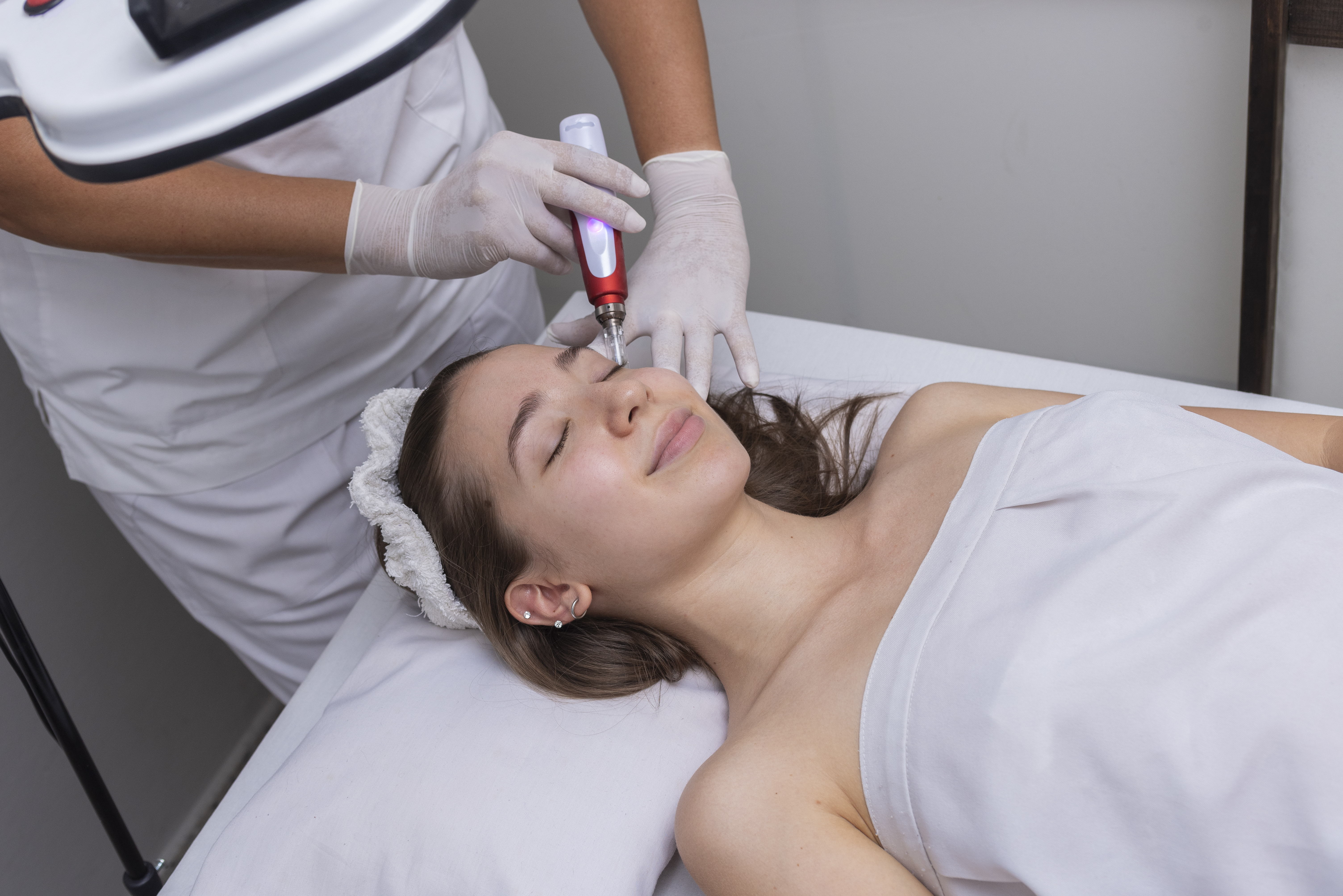 Microneedling treatment in Lahore clinic