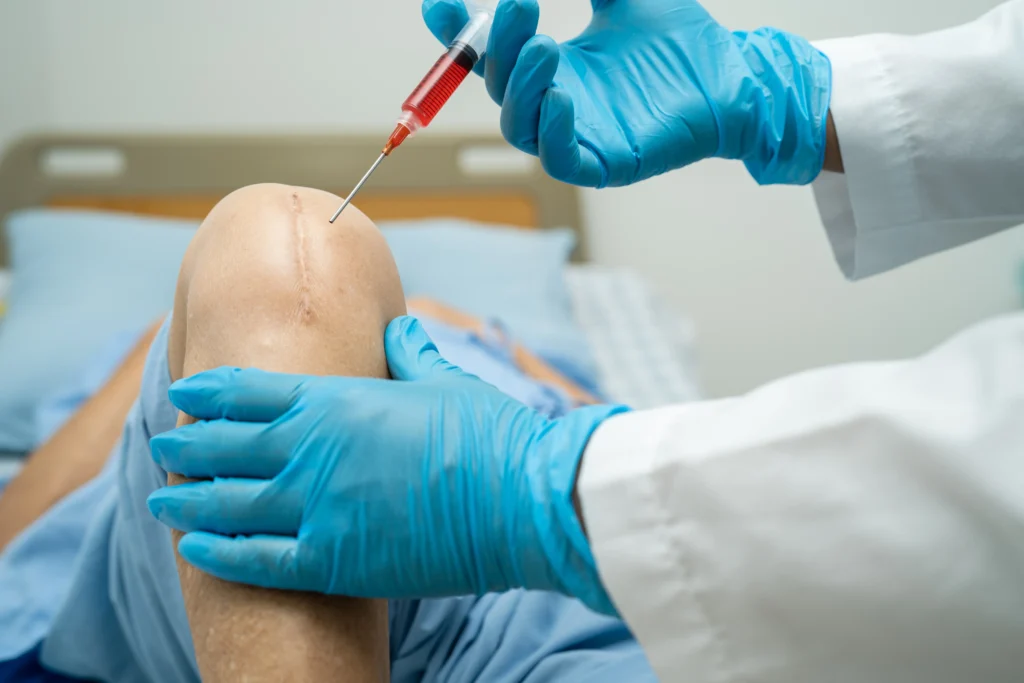 Joint Repair PRP